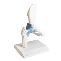 ARTICULATION HANCHE