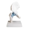 ARTICULATION HANCHE