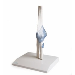 ARTICULATION COUDE